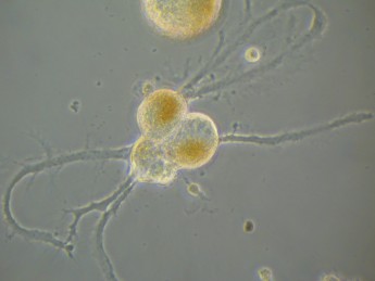 нейроны, полученные из замороженных до температуры жидкого азота (-196оС) нервных ганглиев моллюска