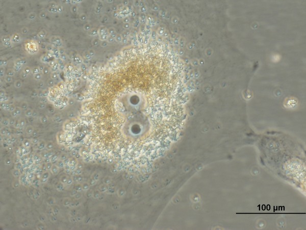 На фото клетка пигментного эпителия сетчатки глаза взрослого человека из 10-дневной первичной культуры. Фазовый контраст. Увеличение Х400.