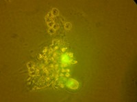 Культура клеток костного мозга реципиента-крысы после введения донорских от мышей клеток с геном «зеленого» белка. Люминисцентная микроскопия в фазовом контрасте