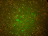 Культура клеток костного мозга реципиента-крысы после введения донорских от мышей клеток с геном «зеленого» белка. Люминисцентная микроскопия в фазовом контрасте
