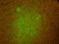 Культура клеток костного мозга реципиента-крысы после введения донорских от мышей клеток с геном «зеленого» белка