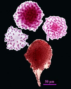 Такие картины «салюта» из популяций синхронно делящихся клеточных ядер можно наблюдать на цитологических препаратах, приготовленных из гонад (семенников) пиявок